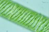 Spirogyra