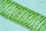 Spirogyra