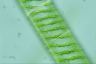 Spirogyra