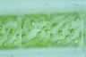 Spirogyra