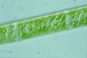 Spirogyra