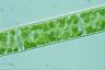 Spirogyra