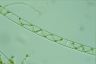 Spirogyra