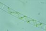 Spirogyra