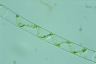 Spirogyra