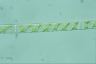 Spirogyra