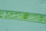 Spirogyra