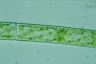 Spirogyra