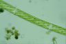 Spirogyra