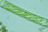 Spirogyra