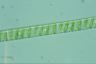 Spirogyra