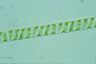 Spirogyra