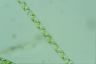 Spirogyra