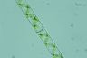 Spirogyra