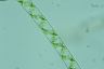 Spirogyra