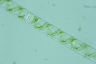 Spirogyra