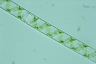 Spirogyra