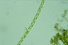 Spirogyra