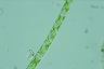 Spirogyra