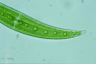 Closterium moniliferum