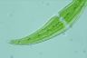 Closterium moniliferum