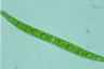 Closterium intermedium