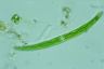 Closterium intermedium