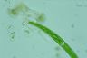 Closterium intermedium