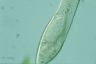 Paramecium caudatum