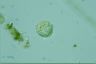 Choanocystis