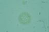 Microcystis