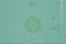 Microcystis