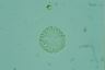 Microcystis