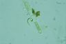 Euglena mutabilis