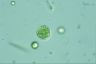 Oocystis lacustris