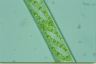 Spirogyra