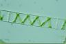 Spirogyra singularis