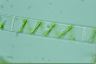 Spirogyra singularis