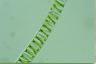 Spirogyra