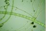 Spirogyra