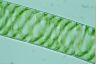 Spirogyra