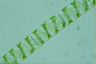 Spirogyra