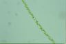 Spirogyra