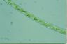 Spirogyra