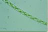 Spirogyra