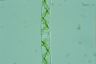 Spirogyra