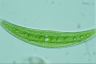 Closterium moniliferum