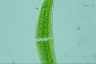 Closterium moniliferum