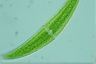 Closterium moniliferum