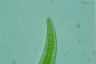 Closterium moniliferum